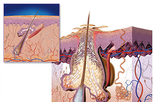 keratinization