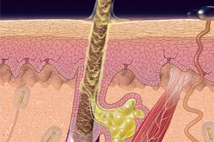 scf24_sebaceous_gland