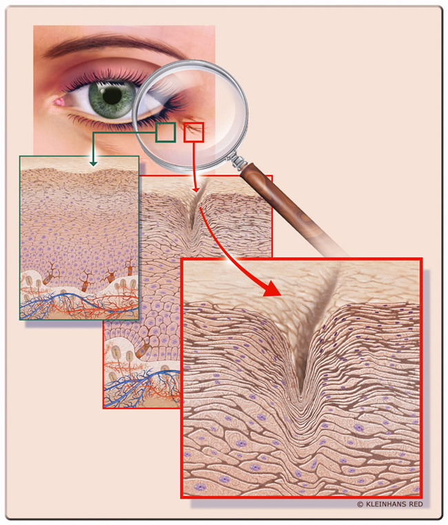 scf33_lines_wrinkles big scf33_lines_wrinkles big