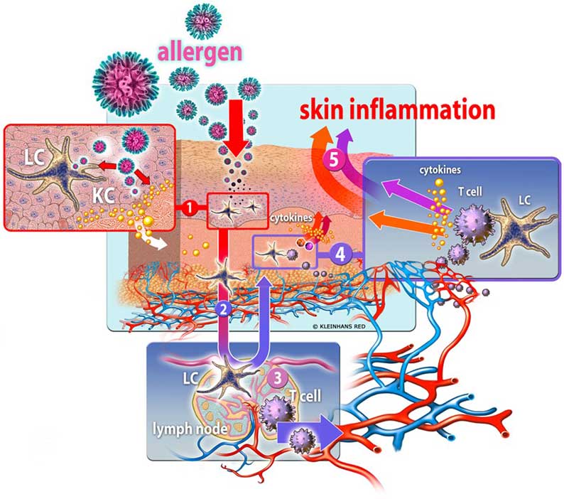 simplified-schematic-representation-_scf_allergene_big simplified-schematic-representation-_scf_allergene_big