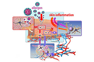 simplified-schematic-representation-_scf_allergene_large_e